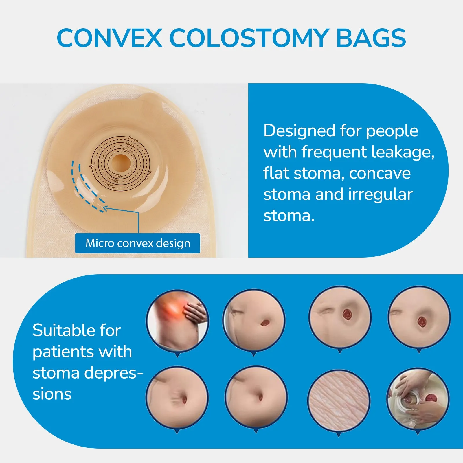 HEAGI Ostomy Supplies, Two-Piece Convex Colostomy Bags Ostomy Pouch with Clamp